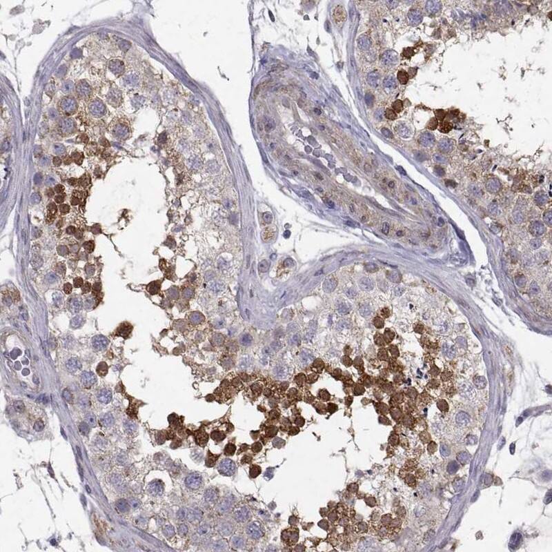 Staining of human testis shows high expression.