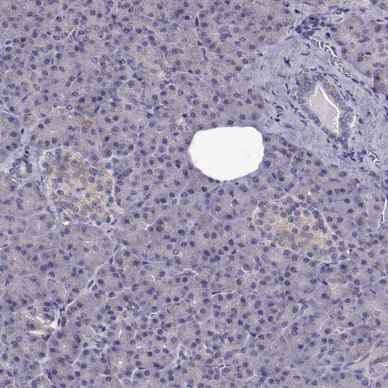 Staining of human pancreas shows low expression as expected.