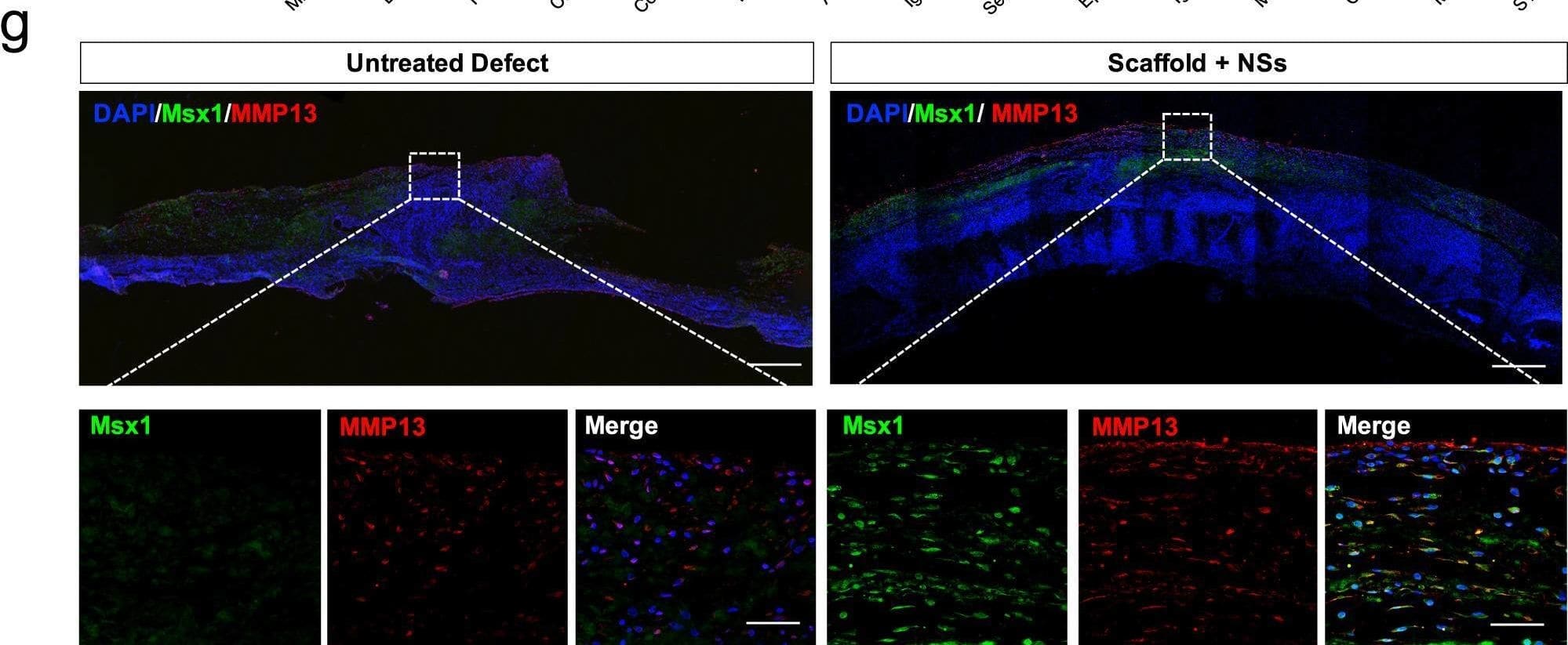 Msx1+ SSCs subset was locally expanded by the in situ culture system with NSs.a Visualization of SSC2 differentiation lineage cells in osteo-lineage cells with UMAP plot, highlighting four specific subsets. b UMAP plot of the four specific subsets. c Relative proportion of cell subsets between Defect and NSs group. d Heatmap and the expression of marker genes of 8 osteo-lineage sub-clusters. Marker genes are provided in source data. e Barplot showing the GO enrichment in SSC2 subset. Markers used for enrichment analysis were selected according to p value (*p 1). Color bar represented the adjusted p values performed by R package clusterProfiler (Benjamini–Hochberg). f Violin plot showing the SSC2 top marker gene expression levels across the whole 8 different subsets. g Co-immunostaining of Msx1 and Mmp13 expression of paraffin sections in Untreated Defect group and Scaffold + NSs group at 2 weeks after defect surgery (bar = 200 μm at low magnification and bar = 30 μm at high magnification), at least three times of experiments were repeated independently. Image collected and cropped by CiteAb from the following open publication (//pubmed.ncbi.nlm.nih.gov/36064711), licensed under a CC-BY license. Not internally tested by Novus Biologicals.