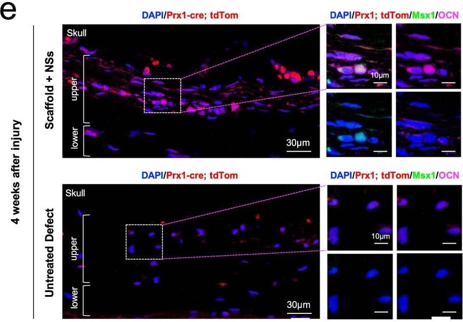 Msx1+ SSCs subset is a source of osteogenesis and closely correlates with endochondral ossification.a Schematic of the assessment of Msx1+ SSCs subset in differentiation hierarchy by Prx1-lineage tracing mice. b, c HE staining of newly formed calvarium tissues in skull bone injury at 2 weeks and 4 weeks after surgery, respectively. d–g Coronal sections of the calvarium tissues from Prx1Cre; RosatdTomato mice co-immunostained with Msx1 and Runx2 (d); Msx1 and OCN (e); Msx1 and ACAN (f); Msx1 and COL2 (g); Scale bars: low magnification: 30 μm, high magnification: 10 μm. At least three times of experiments were repeated independently. Image collected and cropped by CiteAb from the following open publication (//pubmed.ncbi.nlm.nih.gov/36064711), licensed under a CC-BY license. Not internally tested by Novus Biologicals.