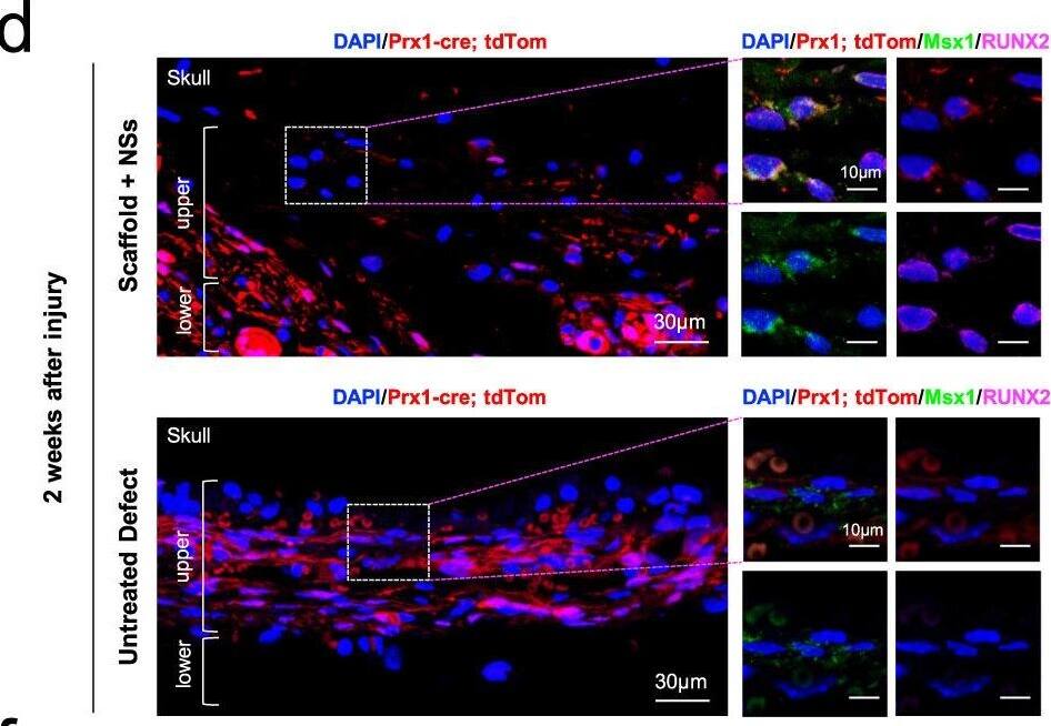 Msx1+ SSCs subset is a source of osteogenesis and closely correlates with endochondral ossification.a Schematic of the assessment of Msx1+ SSCs subset in differentiation hierarchy by Prx1-lineage tracing mice. b, c HE staining of newly formed calvarium tissues in skull bone injury at 2 weeks and 4 weeks after surgery, respectively. d–g Coronal sections of the calvarium tissues from Prx1Cre; RosatdTomato mice co-immunostained with Msx1 and Runx2 (d); Msx1 and OCN (e); Msx1 and ACAN (f); Msx1 and COL2 (g); Scale bars: low magnification: 30 μm, high magnification: 10 μm. At least three times of experiments were repeated independently. Image collected and cropped by CiteAb from the following open publication (//pubmed.ncbi.nlm.nih.gov/36064711), licensed under a CC-BY license. Not internally tested by Novus Biologicals.