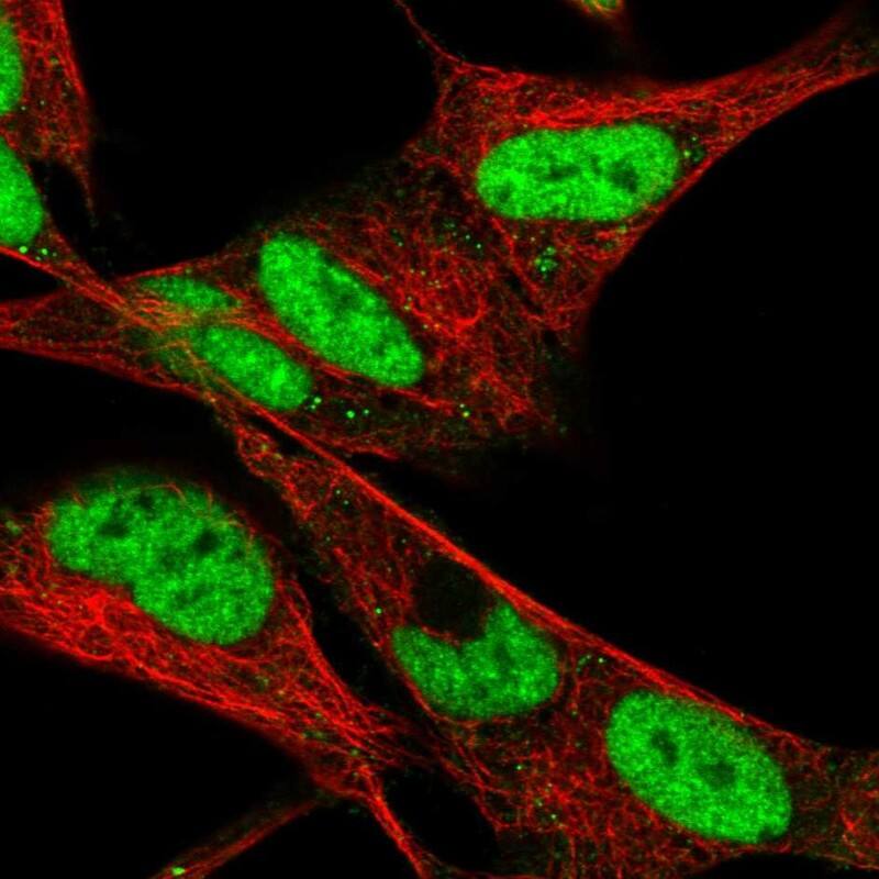 Staining of human cell line SH-SY5Y shows localization to nucleoplasm & vesicles.