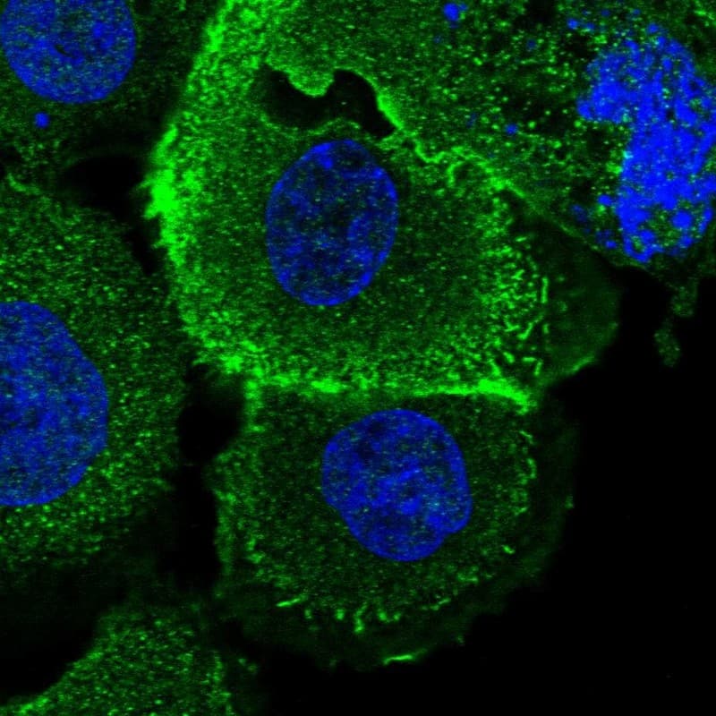 Staining of human cell line A-431 shows localization to plasma membrane & cytosol.