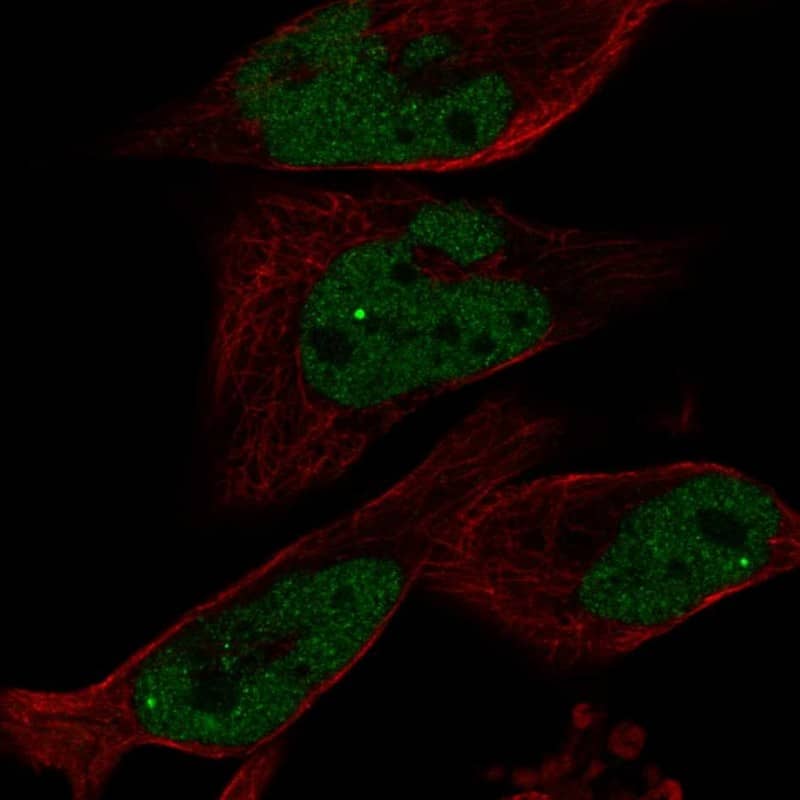 Staining of human cell line RH-30 shows localization to nucleoplasm & nuclear bodies.