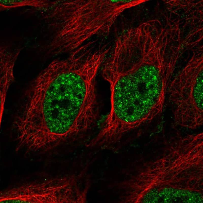 Immunocytochemistry/ Immunofluorescence RAD52 Antibody - BSA Free