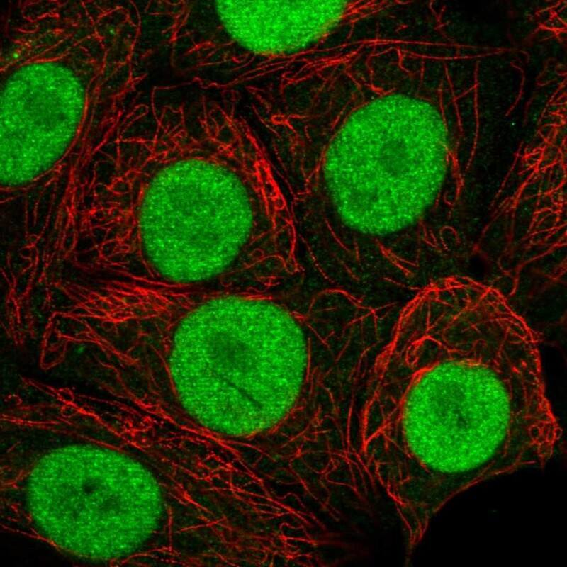 Staining of human cell line MCF7 shows localization to nucleus.