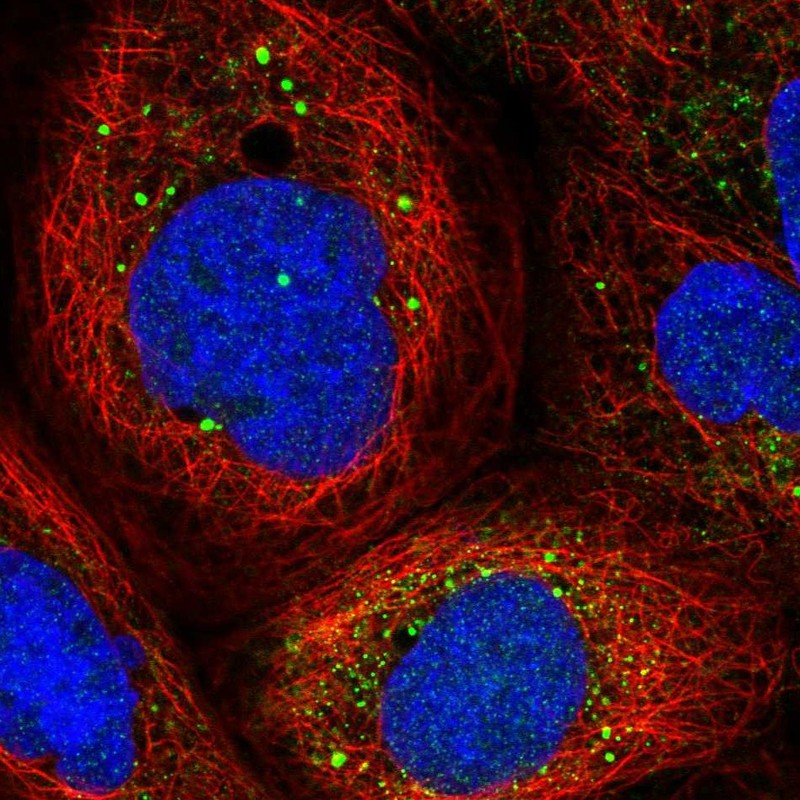 Staining of human cell line A-431 shows localization to vesicles.