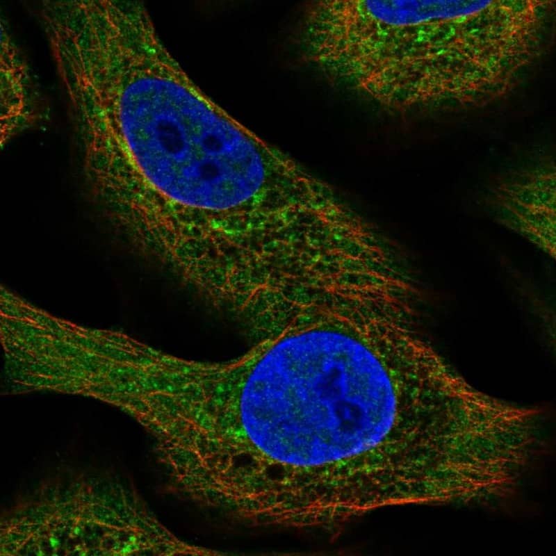 <b>Independent Antibodies Validation. </b>Staining of human cell line A549 shows localization to cytosol, the Golgi apparatus & vesicles.