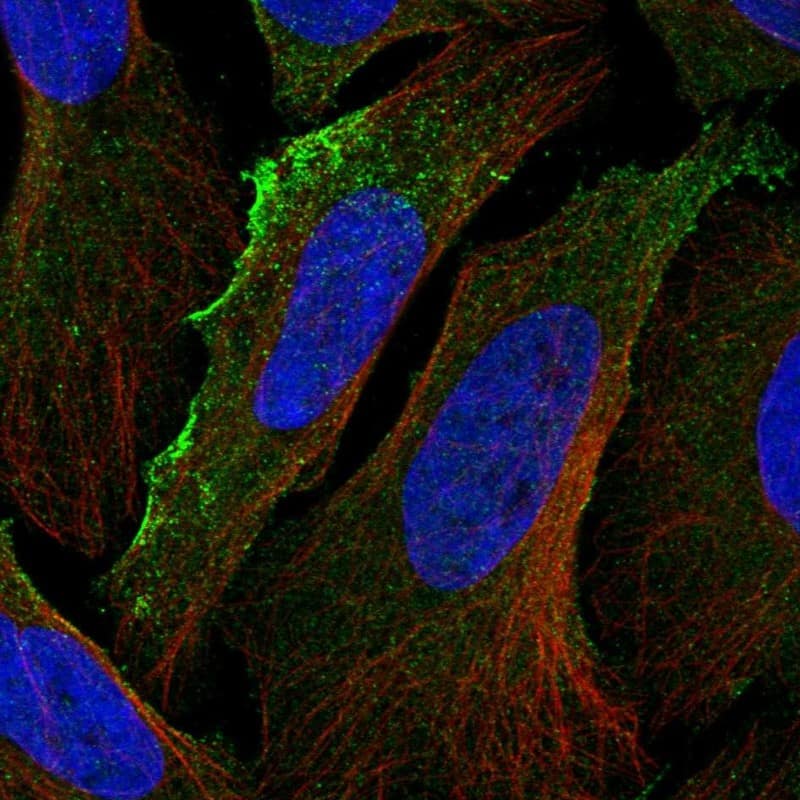 Staining of human cell line U-2 OS shows localization to plasma membrane & vesicles.