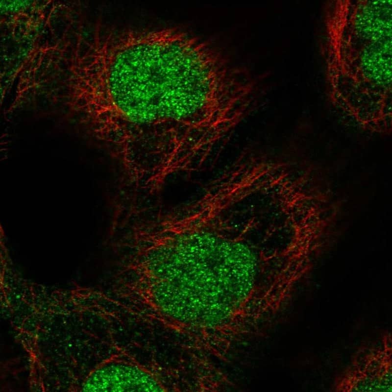 Staining of human cell line A-431 shows localization to nucleoplasm.