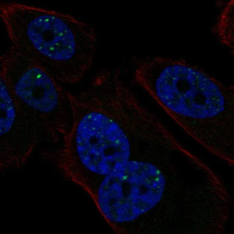 Staining of human cell line PC-3 shows localization to nuclear bodies.