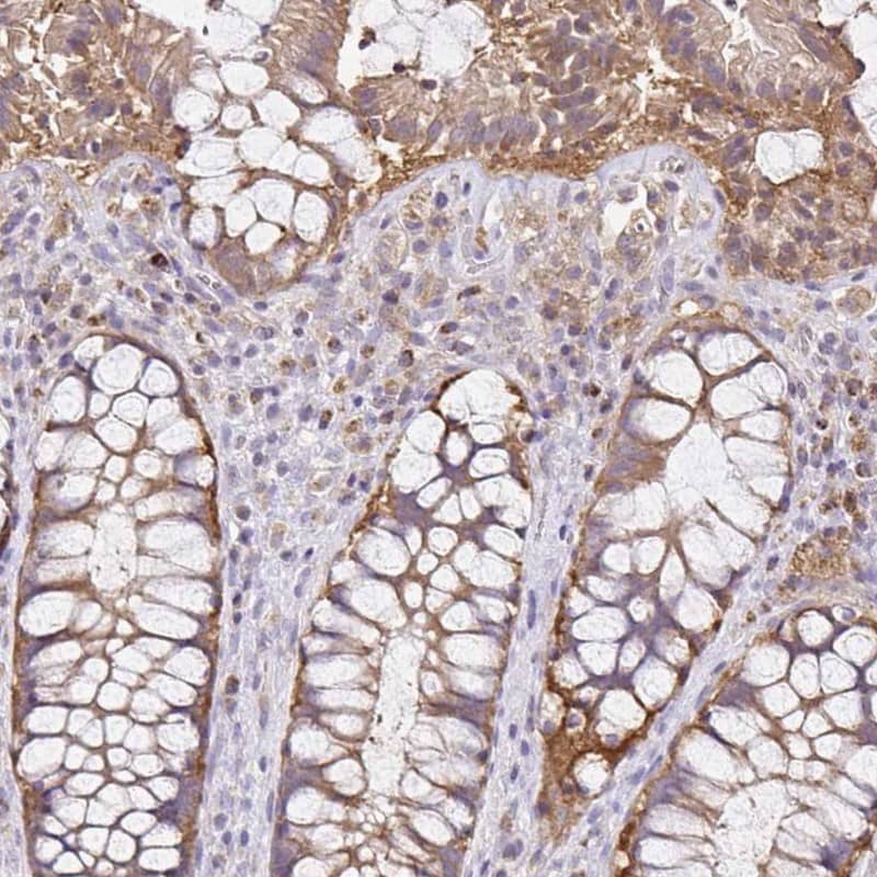 Immunohistochemistry-Paraffin NAD Synthetase Antibody - BSA Free