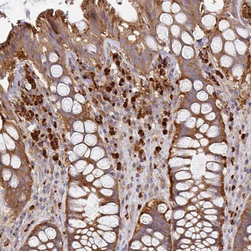 Immunohistochemistry-Paraffin NAD Synthetase Antibody - BSA Free