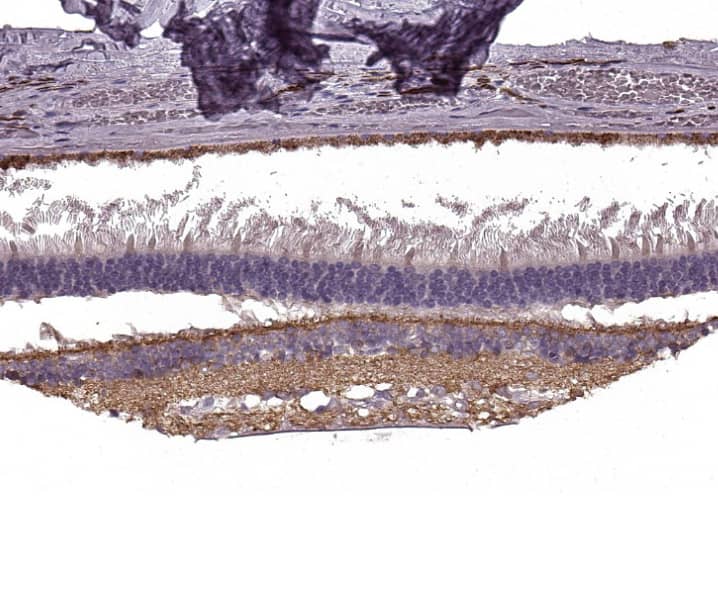  Staining of human retina shows strong cytoplasmic positivity in nerve fibers.