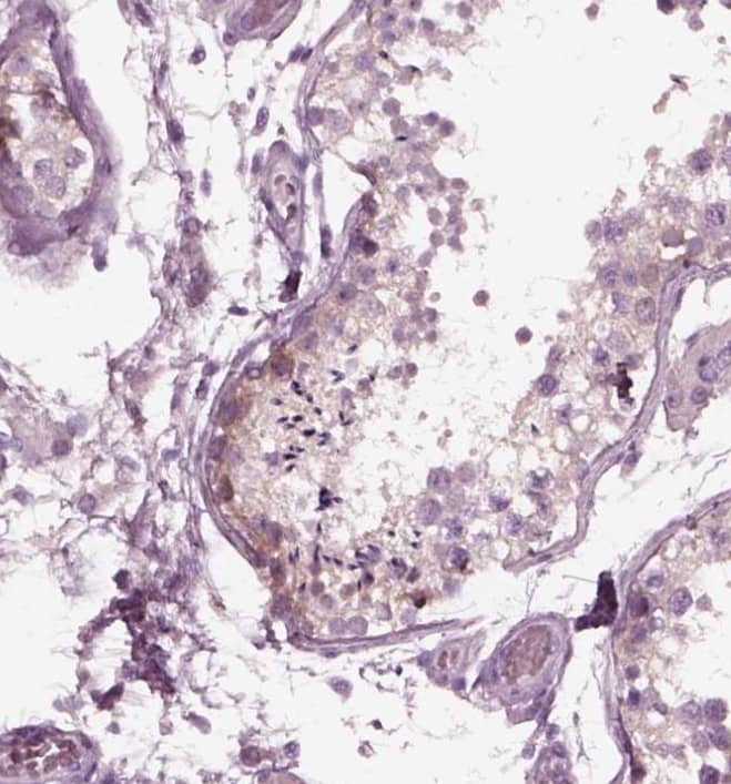 Staining of human testis shows weak membranous and cytoplasmic positivity in spermatogonia.