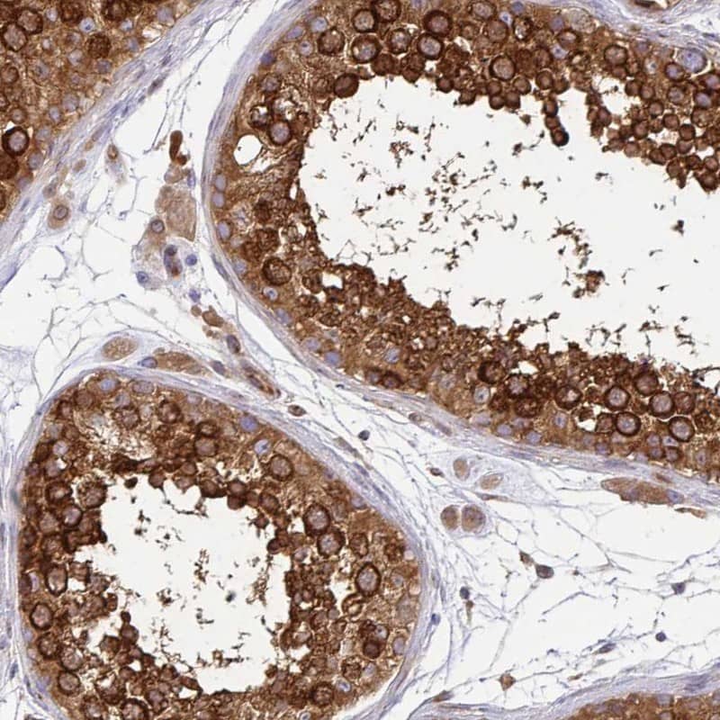 Staining of human testis shows strong cytoplasmic positivity in cells in seminiferous ducts.