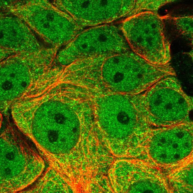 Staining of human cell line MCF7 shows localization to nucleoplasm & cytosol.