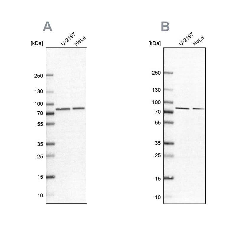 <b>Independent Antibodies Validation. </b>Analysis using NBP2-58575 (A) shows similar pattern to independent antibody NBP2-13722 (B).