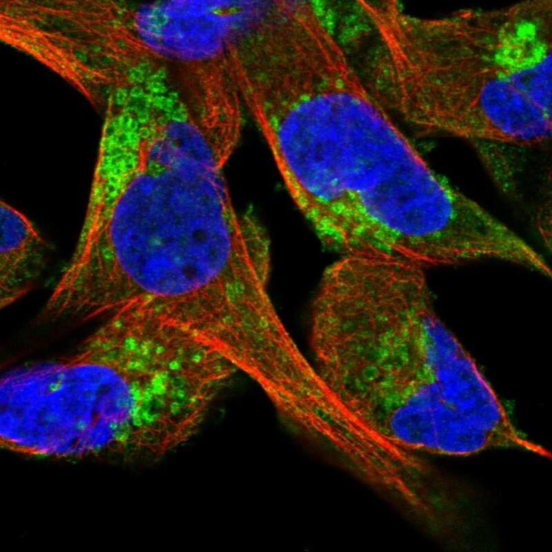 Staining of human cell line RH-30 shows localization to cytosol & the Golgi apparatus.