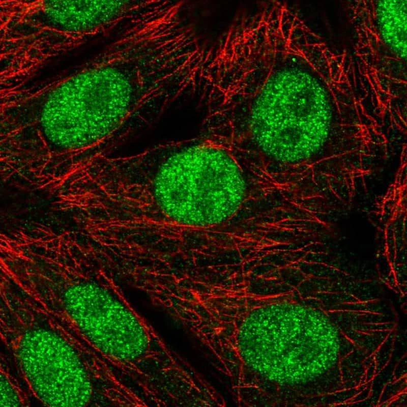Immunocytochemistry/ Immunofluorescence RNF220 Antibody - BSA Free