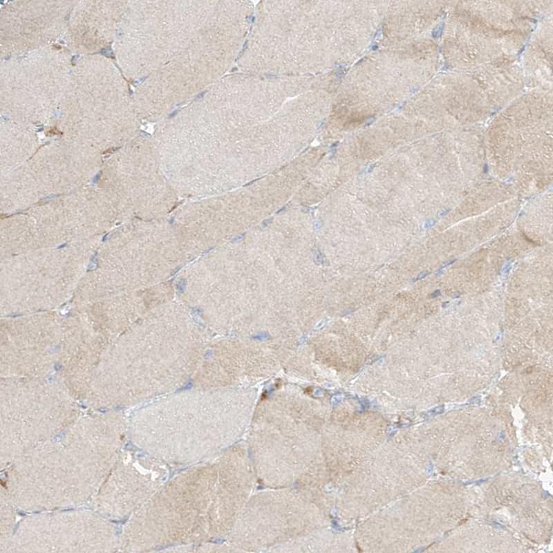 Immunohistochemistry-Paraffin PGD Antibody - BSA Free