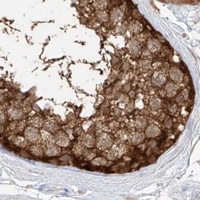 Immunohistochemistry-Paraffin PGD Antibody - BSA Free