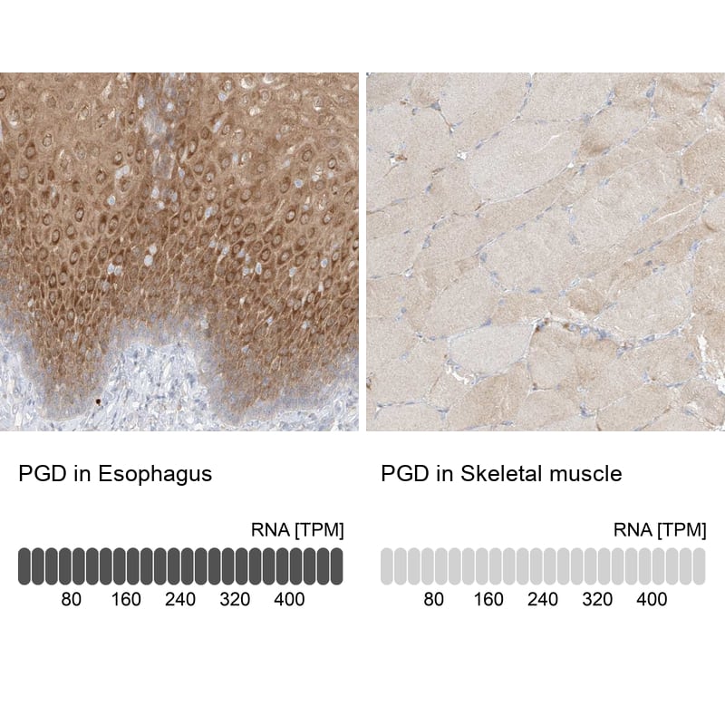 Immunohistochemistry-Paraffin PGD Antibody - BSA Free