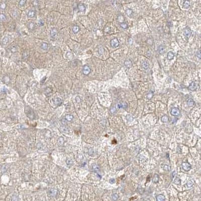 Immunohistochemistry-Paraffin PGD Antibody - BSA Free