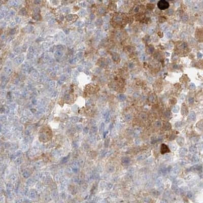 Immunohistochemistry-Paraffin PGD Antibody - BSA Free
