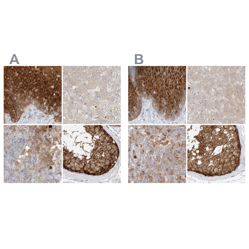 Immunohistochemistry-Paraffin PGD Antibody - BSA Free