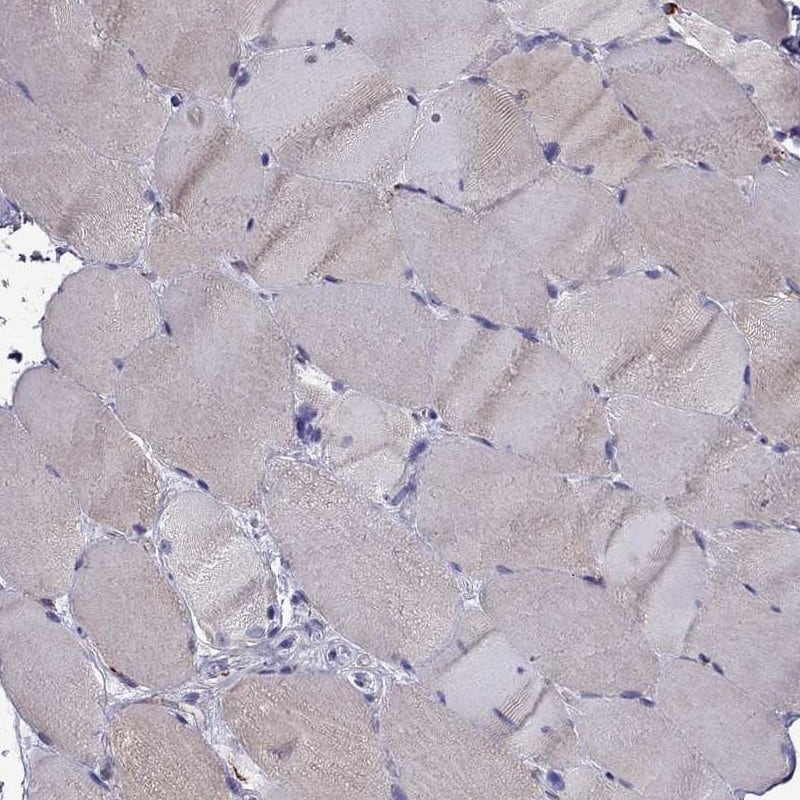 Staining of human skeletal muscle shows low expression as expected.