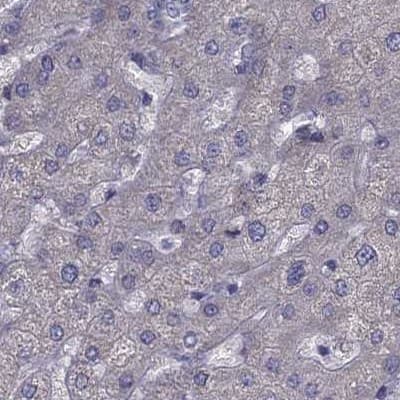 Staining of human liver.