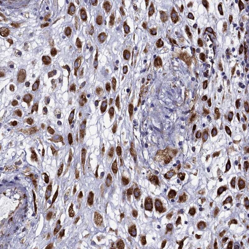 Staining of human placenta shows high expression.