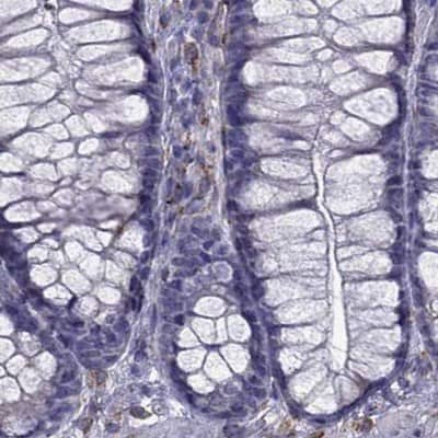 Staining of human colon.