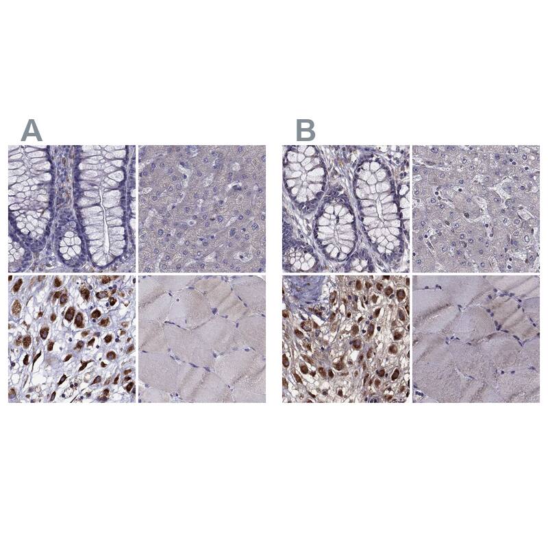 <b>Orthogonal Strategies Validation. </b>Staining of human colon, liver, placenta and skeletal muscle HPA038677 (A) shows similar protein distribution across tissues to independent antibody HPA038678 (B).