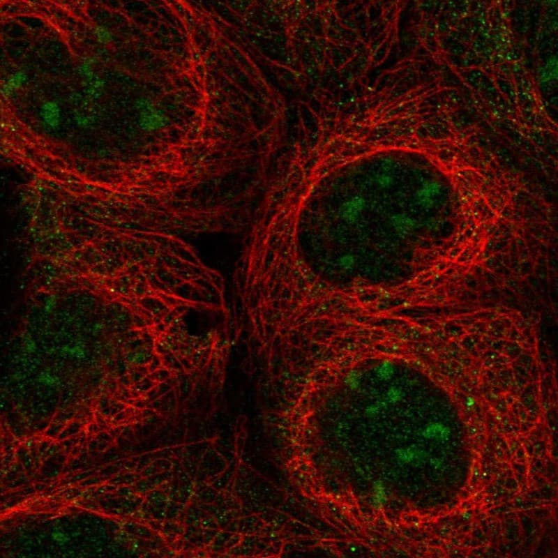 Immunocytochemistry/ Immunofluorescence UBXD5 Antibody - BSA Free