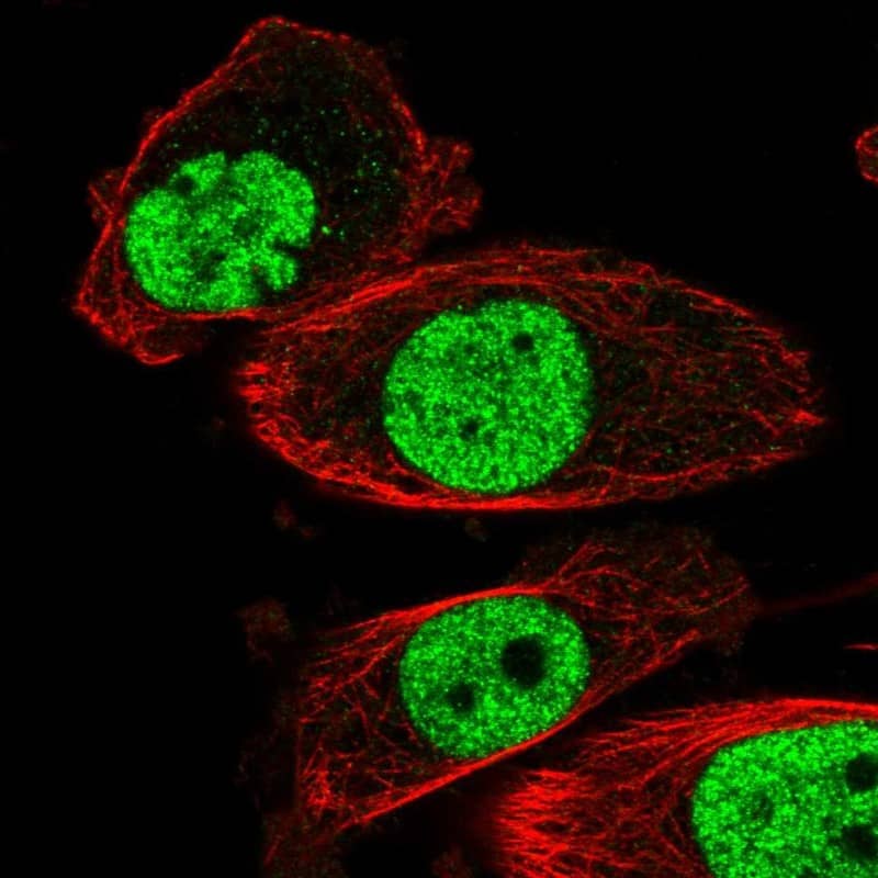 Staining of human cell line PC-3 shows localization to nucleoplasm.