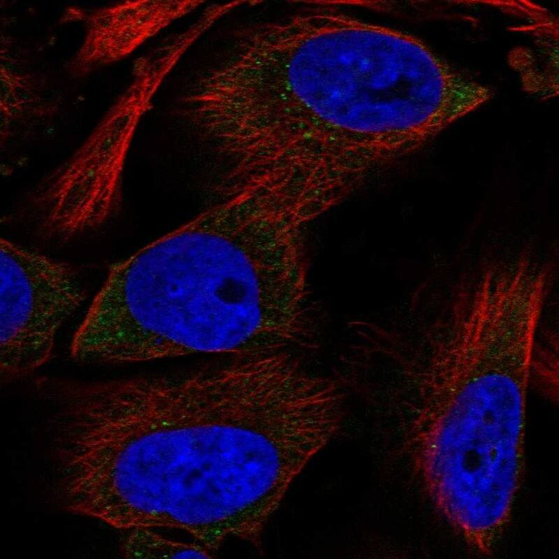 Staining of human cell line U-251 MG shows localization to cytosol.