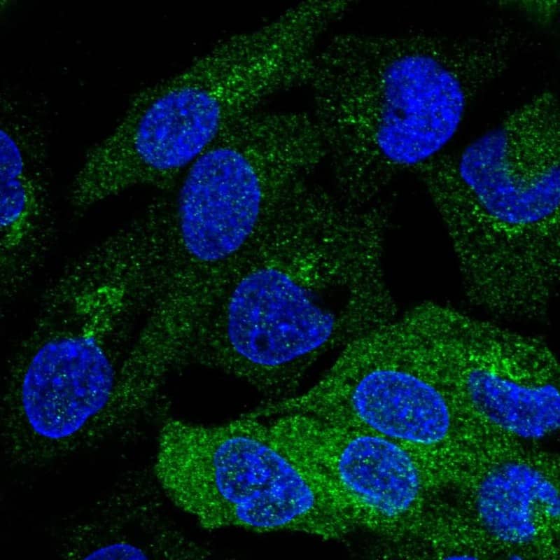 Staining of human cell line Hep G2 shows localization to endoplasmic reticulum & the Golgi apparatus.
