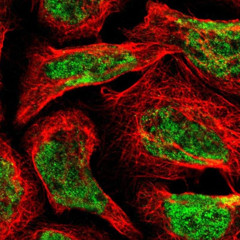 <b>Orthogonal Strategies Validation. </b>Staining of human cell line A-431 shows localization to nucleus.