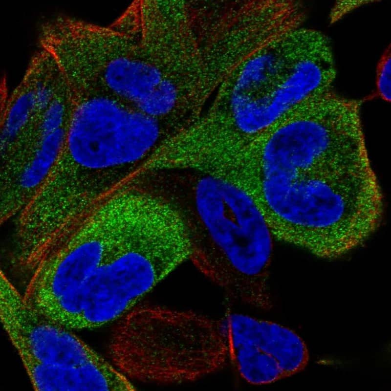Staining of human cell line RH-30 shows localization to cytosol.