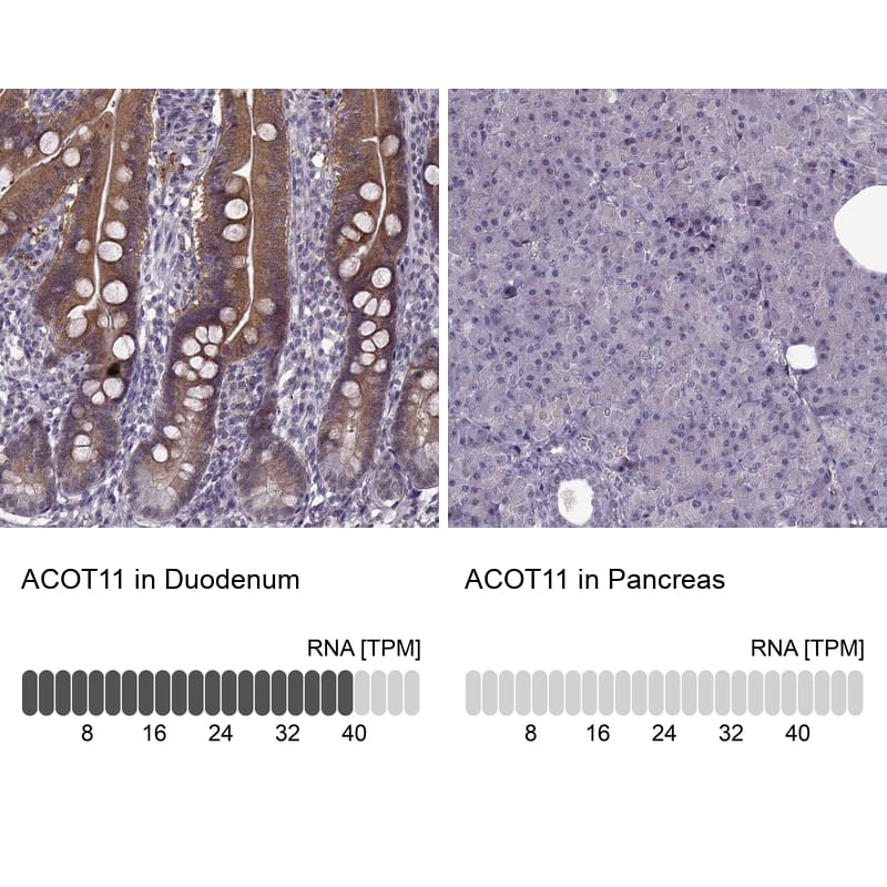Immunohistochemistry-Paraffin ACOT11 Antibody - BSA Free