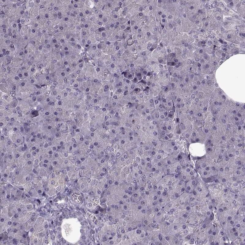 Staining of human pancreas shows low expression as expected.