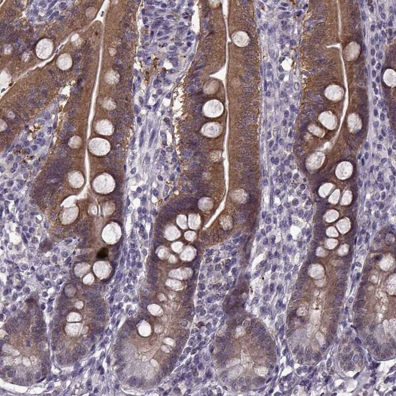 Staining of human duodenum shows high expression.