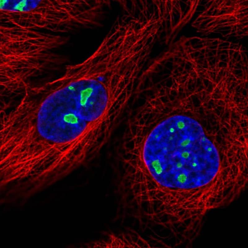 <b>Genetic Strategies Validation. </b>Staining of human cell line A-431 shows localization to nucleoli.