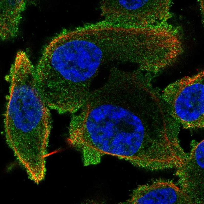 Staining of human cell line PC-3 shows localization to cytosol.