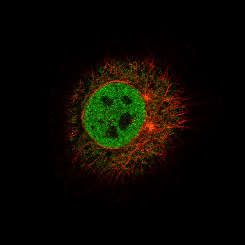 Staining of BEWO cells, showing specific staining in the nucleoplasm in green. Microtubule- and nuclear probes are visualized in red and blue, respectively (where available).