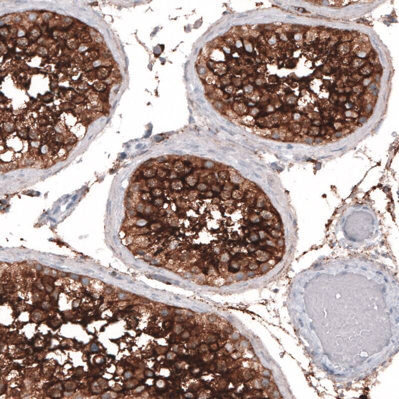 Staining of human testis shows strong membranous positivity in cells in seminiferous ducts.