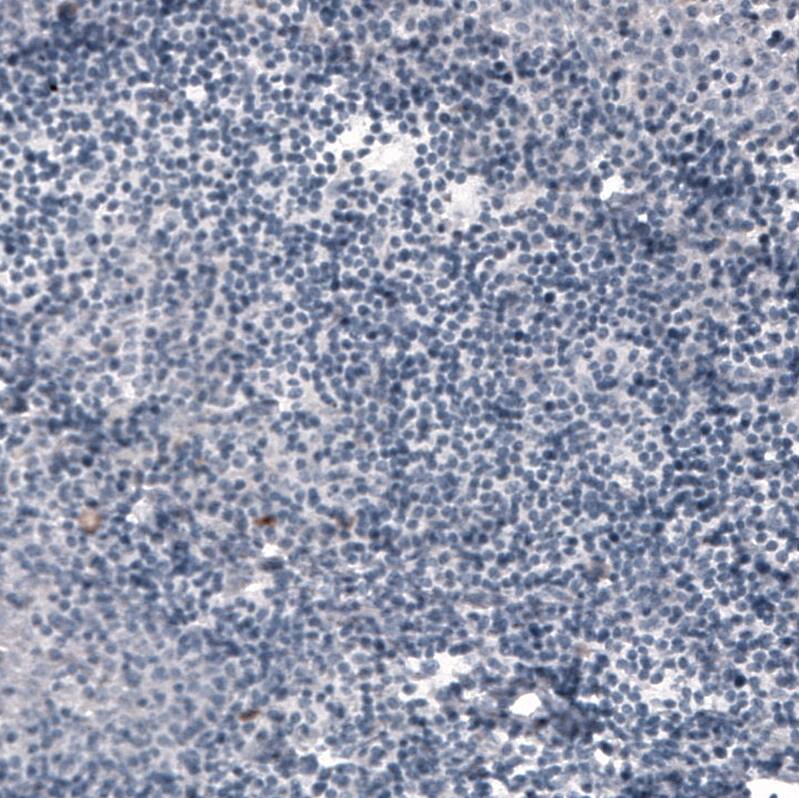 Staining of human tonsil shows no positivity in non-germinal center cells as expected.
