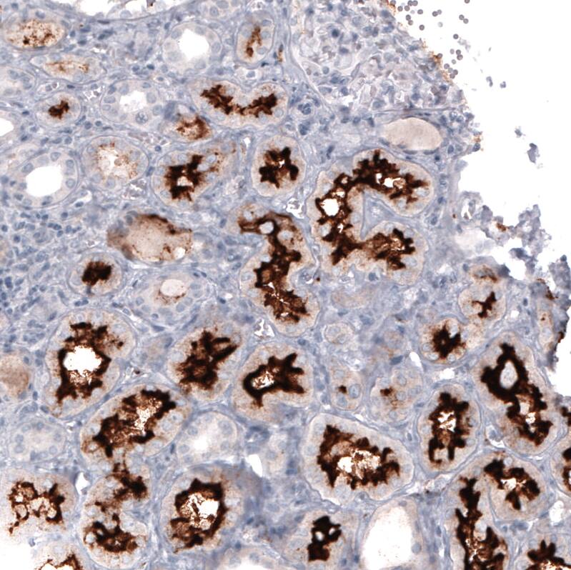 Staining of human kidney shows strong positivity in apical membrane in cells in proximal tubules.
